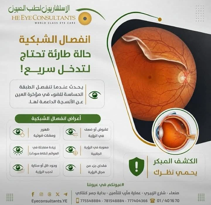 انفصال الشبكية حاله طارئة تحتاج تدخل سريع